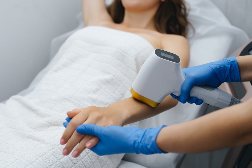 Laser Hair Removal Cost in Anderson
