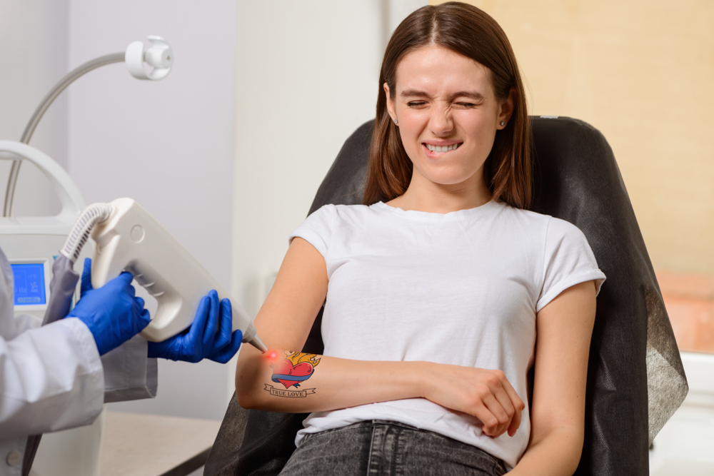 Is Tattoo Removal Painful?