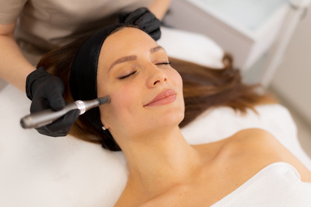 How to Prepare for a Microneedling Appointment in Anderson, South Carolina