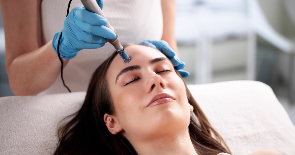 Is Microneedling in Anderson, SC a Game Changer or a Gamble for Your Skin?