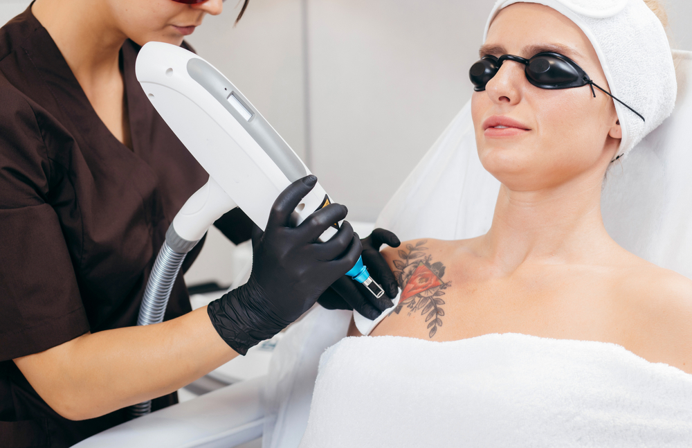Laser Tattoo Removal With Advanced Laser Technology in Clemson, SC