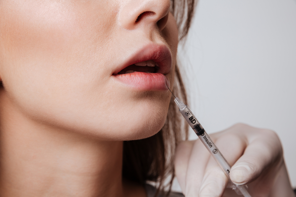 Same-Day Lip Filler Appointments in Anderson, SC: Costs & Expectations